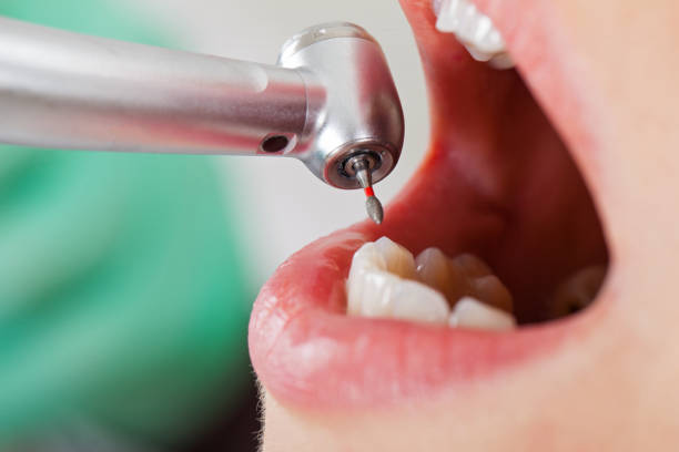 Best Emergency Broken Tooth Repair in Olney, TX